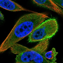 HT021 Antibody, Novus Biologicals:Antibodies:Primary Antibodies